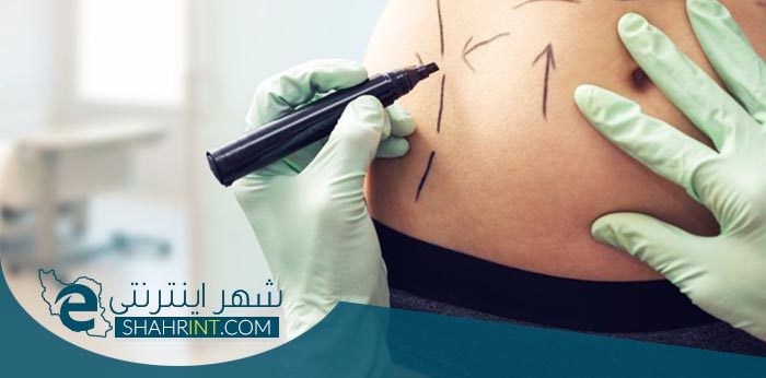 پیکرتراشی یا کانتورینگ