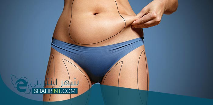 پیکرتراشی یا کانتورینگ